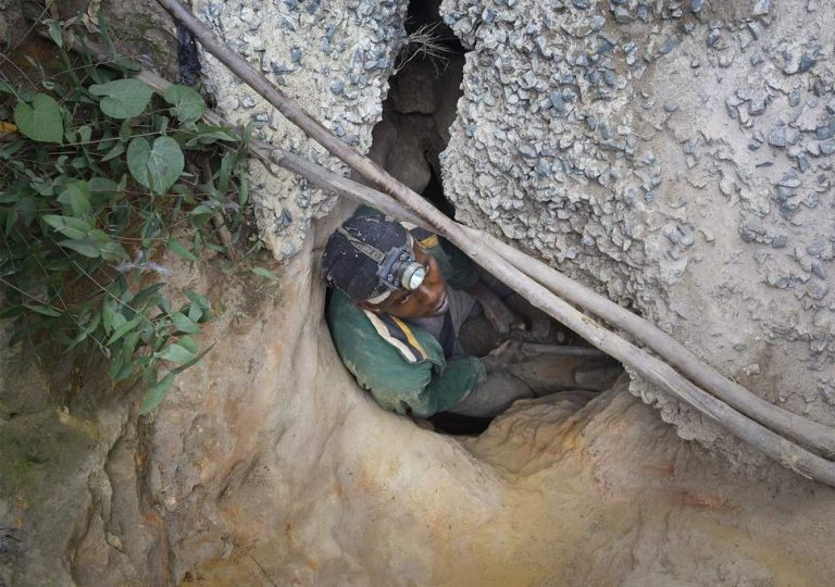 Illegal miner suffers amputation of legs in freak accident