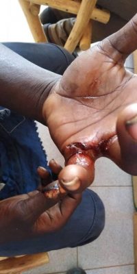 Mashurugwi injury